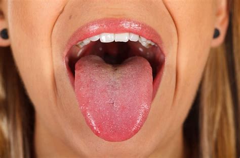 9 Surprising Secrets Your Tongue Can Reveal About Your Health Aol