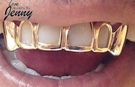 Gold is a chemical element with the symbol au (from latin: Real Yellow Gold Teeth Grills Custom fit 6pc.*FREE ...