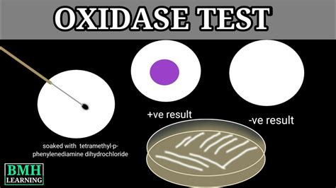 Oxidase Test Youtube