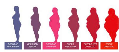 CATEGORÍAS DE LA OBESIDAD CI LAP