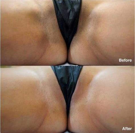 What Is Vaginal Bleaching And Anal Bleaching Real Styling Solutions