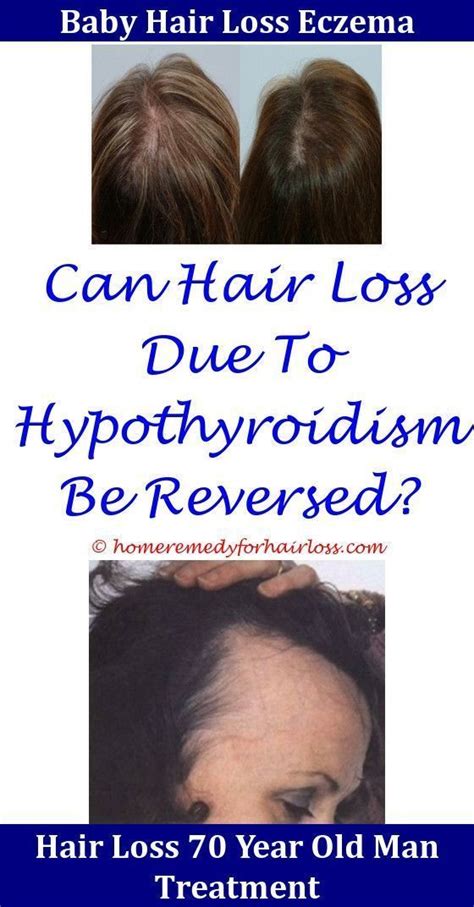 And more research needs to be done on whether remicade can cause weight gain. Does remicade cause hair loss > ONETTECHNOLOGIESINDIA.COM