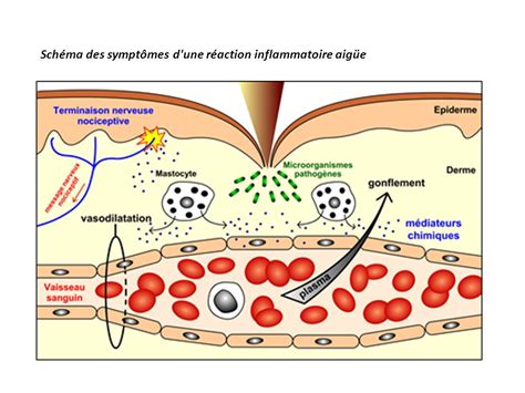 Une inflammation est une réaction de défense...  [Terminale S]  QCM n