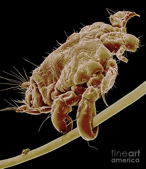Pubic Louse Photograph By Steve Gschmeissner Science Photo Library