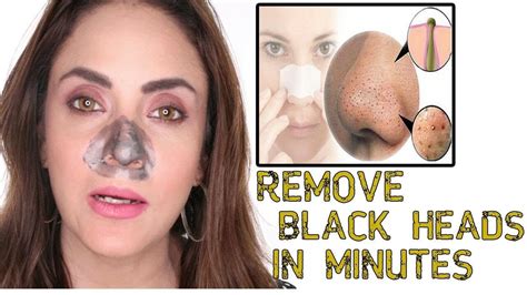 How To Remove Blackheads From Nose And Close Pores Howotremvo