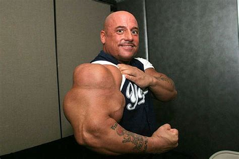 Another Synthol Victim 12 Pics