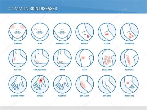 Skin Diseases Icons — Stock Vector © Elenabs 104389256