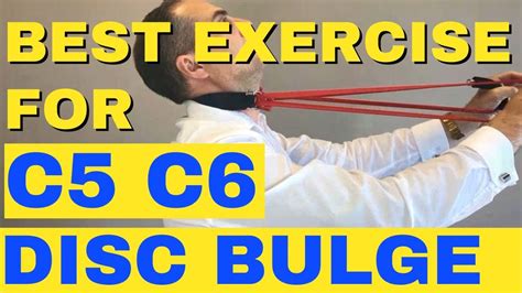 Best Exercises For C5 C6 Bulging Disc 2021 C5 C6 Herniated Disc
