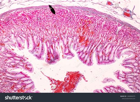 Tissue Of Stomach Under The Microscopic Physiology Of The Stomach For
