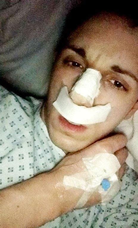 ‘britains Vainest Man Begs Nhs To Reverse £50k Surgery He Underwent