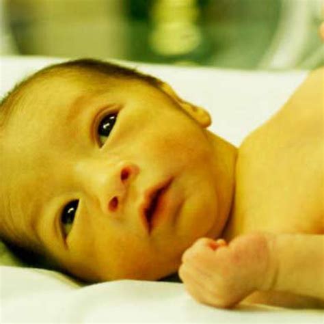 Meski umumnya tidak berbahaya, ada beberapa hal yang perlu diperhatikan bila bayi menunjukkan. www.sehatfresh.com