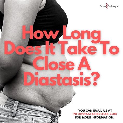 Diastasis Recti Test Step By Step Guide How To Exercise Safely Artofit