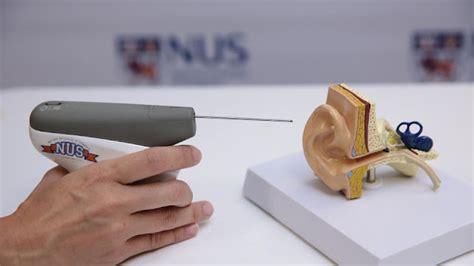 New Handheld Device For Treatment Of Otitis Media With Effusion Ome
