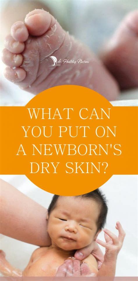 What Can You Put On A Newborns Dry Skin Newborn Dry Skin Baby Dry