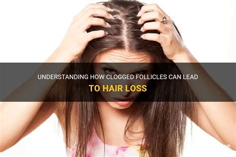 Understanding How Clogged Follicles Can Lead To Hair Loss Shunhair