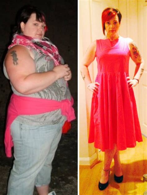 Woman Drops 13 Stone After Being Told Lose Weight Or Lose Your Womb Metro News