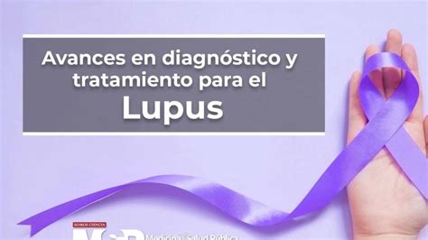 Avances En Diagnóstico Y Tratamiento Para El Lupus