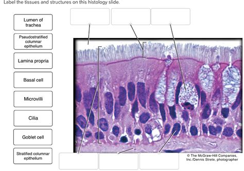 Pseudostratified Columnar Epithelium Histology Slides Psychology My