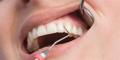 Periodontology Periodontology Bern Dental Practice Bern