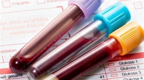 Need to identify early indications of Alzheimer's sickness This fresh blood test will help you