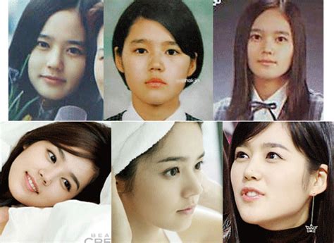 Did seo hyun jin undergo plastic surgery? Crunchyroll - Forum - What actors/actress is born ...
