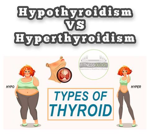 Hypothyroidism Vs Hyperthyroidism Whats The Difference Fitnessology