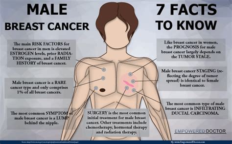 male breast cancer 7 facts to know visual ly