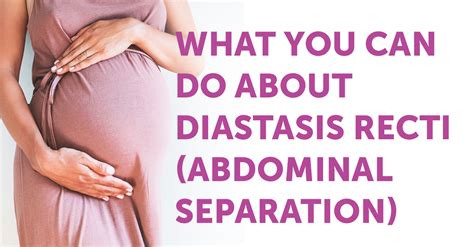 What You Can Do About Diastis Recti Abdominal Separation Pt And Me
