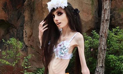 Who Is Eugenia Cooney Youtuber Battling Severe Anorexia Displays