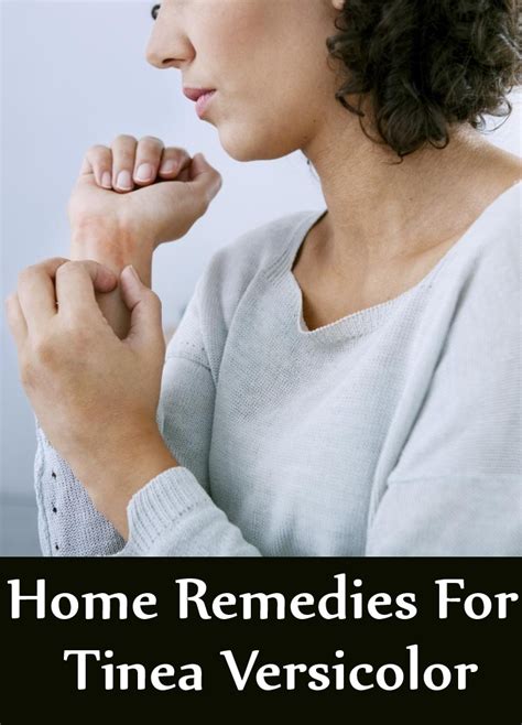 7 Home Remedies For Tinea Versicolor Search Home Remedy