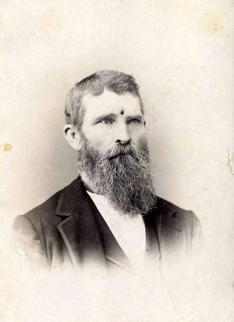 Portrait Of Jacob C Miller A Civil War Veteran Who Lived With An Open