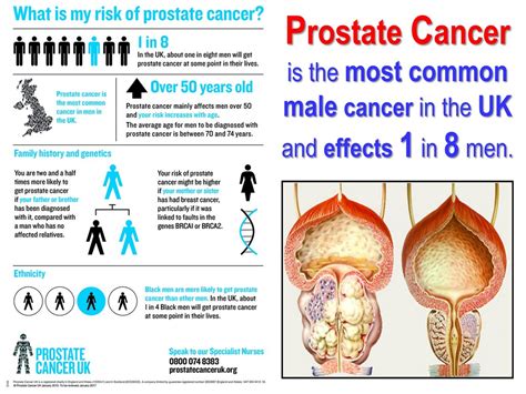 Prostate Cancer Full Health Secrets