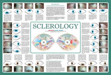 Sclerology Wallchart Grand Medicine Eyology Iridology