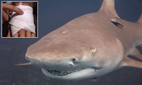 Three People Injured In Shark Attacks In Just Two Days Including Two