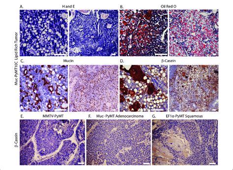 Abundant Lipid Vacuoles And β Casein Expression In Lipid Rich