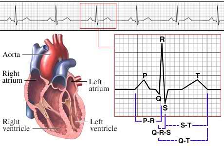 Kedua cara di atas digunakan apabila irama ekg teratur, bila irama ekg tidak teratur. Makalah EKG (elektrokardiogram) Full ~ BelajarEKG