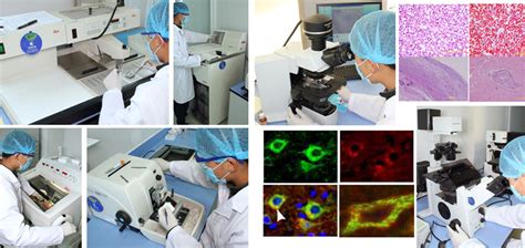 Anatomical Pathologykunming Biomed International Kbi