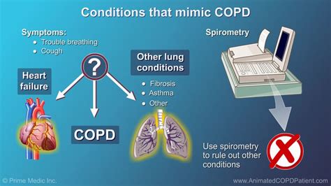 There Are Many Other Conditions That Can Be Confused With Copd People
