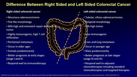 Patho Minutes Right Sided Vs Left Sided Colorectal Cancer Youtube