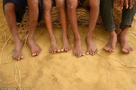 Experts Baffled By Group Of Relatives In India Who ALL Have Fingers And Toes Daily Mail