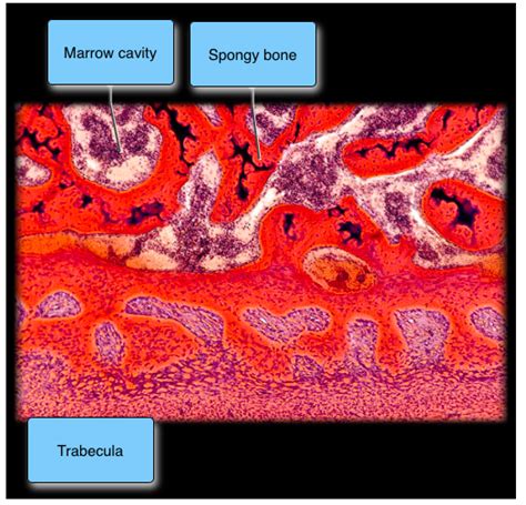 Solved Cavity Spongy Bone Trabecula