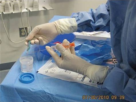 After The Biopsy Needle Has Been Deployed The Specimen Is Placed