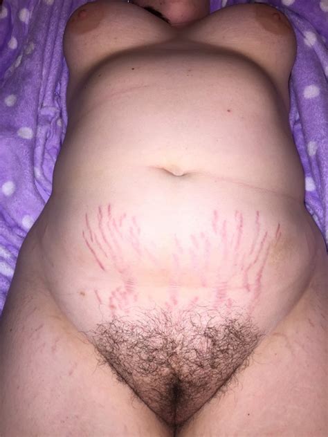Nude Housewife With Stretch Marks