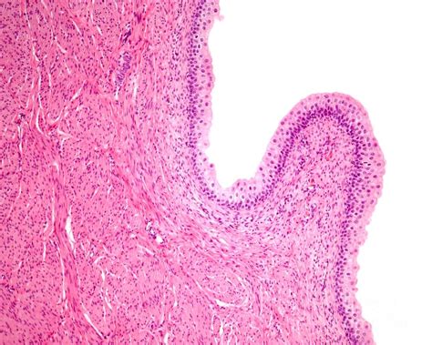 Urinary Bladder Mucosa Photograph By Jose Calvo Science Photo Library