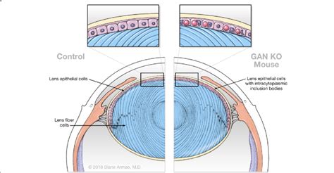 Ocular Lens Control Lens Cells Exist In Two Distinct Forms Lens