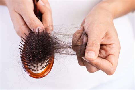 7 Causas De La Pérdida Del Cabello Y Cómo Evitarlas — Mejor Con Salud