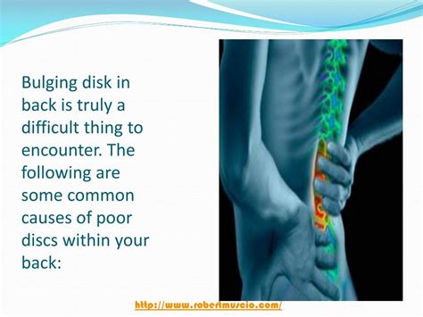 Ppt Causes Symptoms And Treatment Of A Bulging Disc Lower Back