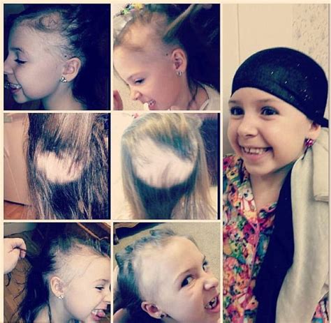 7 Year Old Girl With Alopecia Has Her Head Covered In Sparkly Jewels At