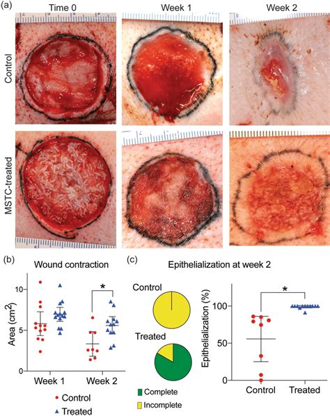 Accelerated Re Epithelialization And Reduced Contraction In Wounds