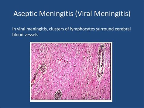 Meningitis Pathology Ppt Download
